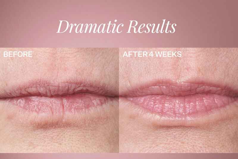 StriVectin Anti-Wrinkle Double Fix for Lips - lūpų putlinimo ir drėkinimo priemonė, mažinanti raukšles aplink lūpas
