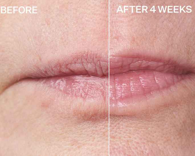 StriVectin Anti-Wrinkle Double Fix for Lips - lūpų putlinimo ir drėkinimo priemonė, mažinanti raukšles aplink lūpas