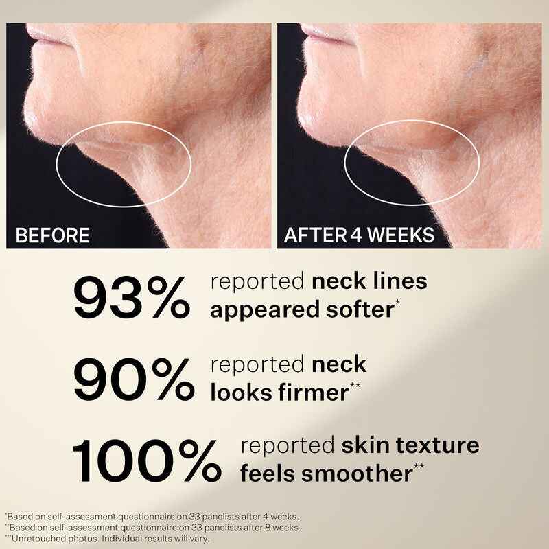 Peptight™ Tightening Neck Serum Roller Stangrinantis kaklo serumas su aplikatorium