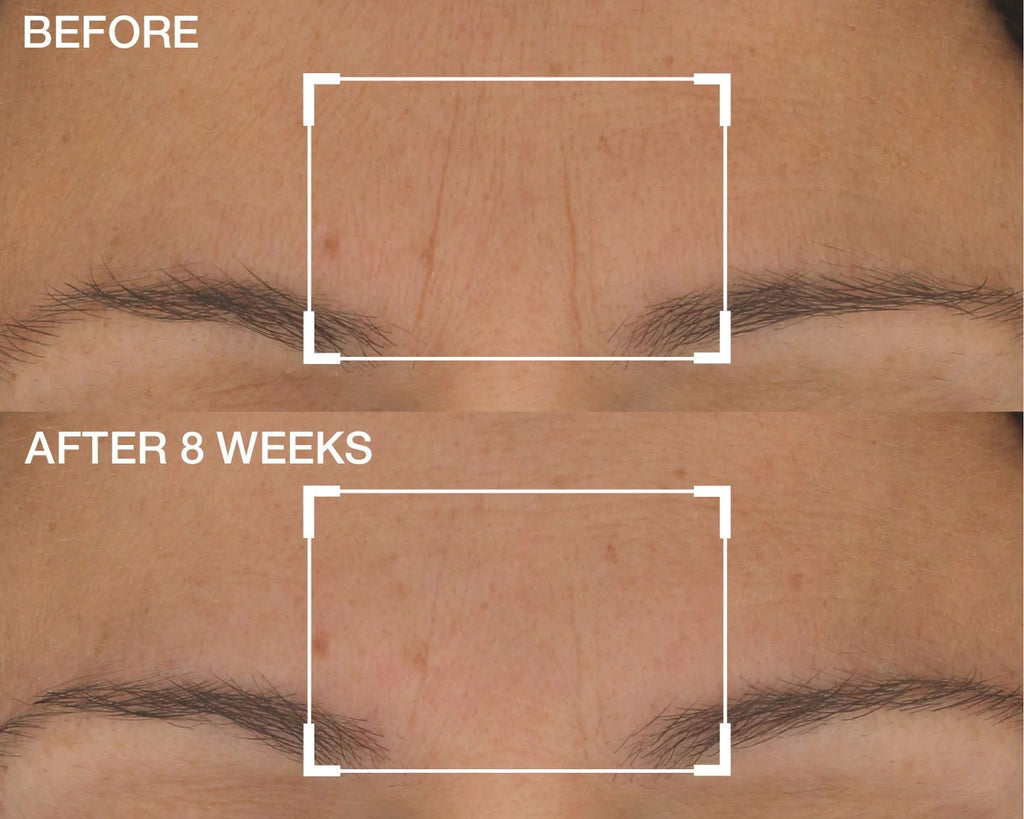 StriVectin Advanced Retinol S.T.A.R. Light Night Oil 