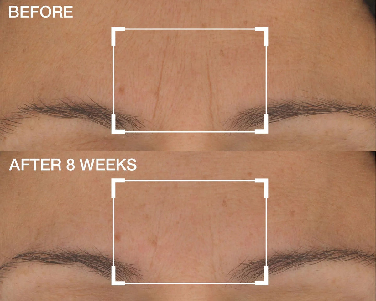 StriVectin Advanced Retinol S.T.A.R. Light Night Oil 