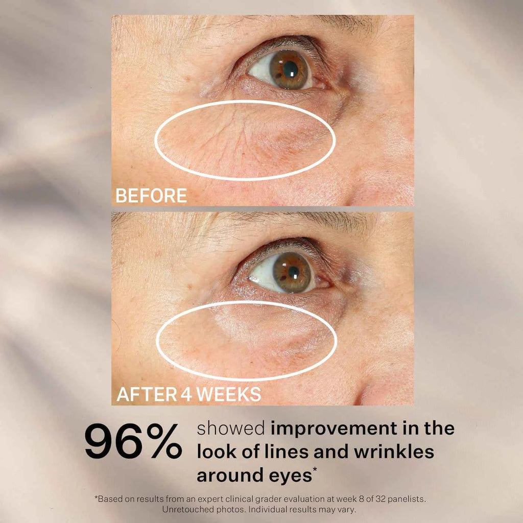 Peptight™ 360˚ TIGHTENING EYE SERUM stangrinantis paakių serumas su aplikatorium 30 ml